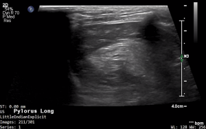 Feline Pylorus (Longitudinal) 1 - NORMAL