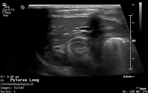 Feline Pylorus (Longitudinal) 2 - NORMAL