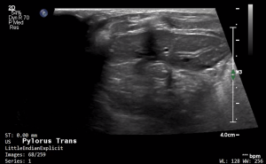 Feline Pylorus (Transverse) - NORMAL