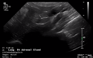 Feline Right Adrenal (Longitudinal) - NORMAL