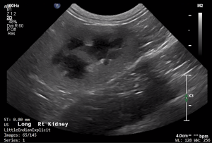Feline Right Kidney (Longitudinal) 2 - NORMAL