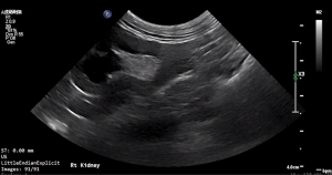 Feline Right Kidney (Longitudinal) 3 - NORMAL