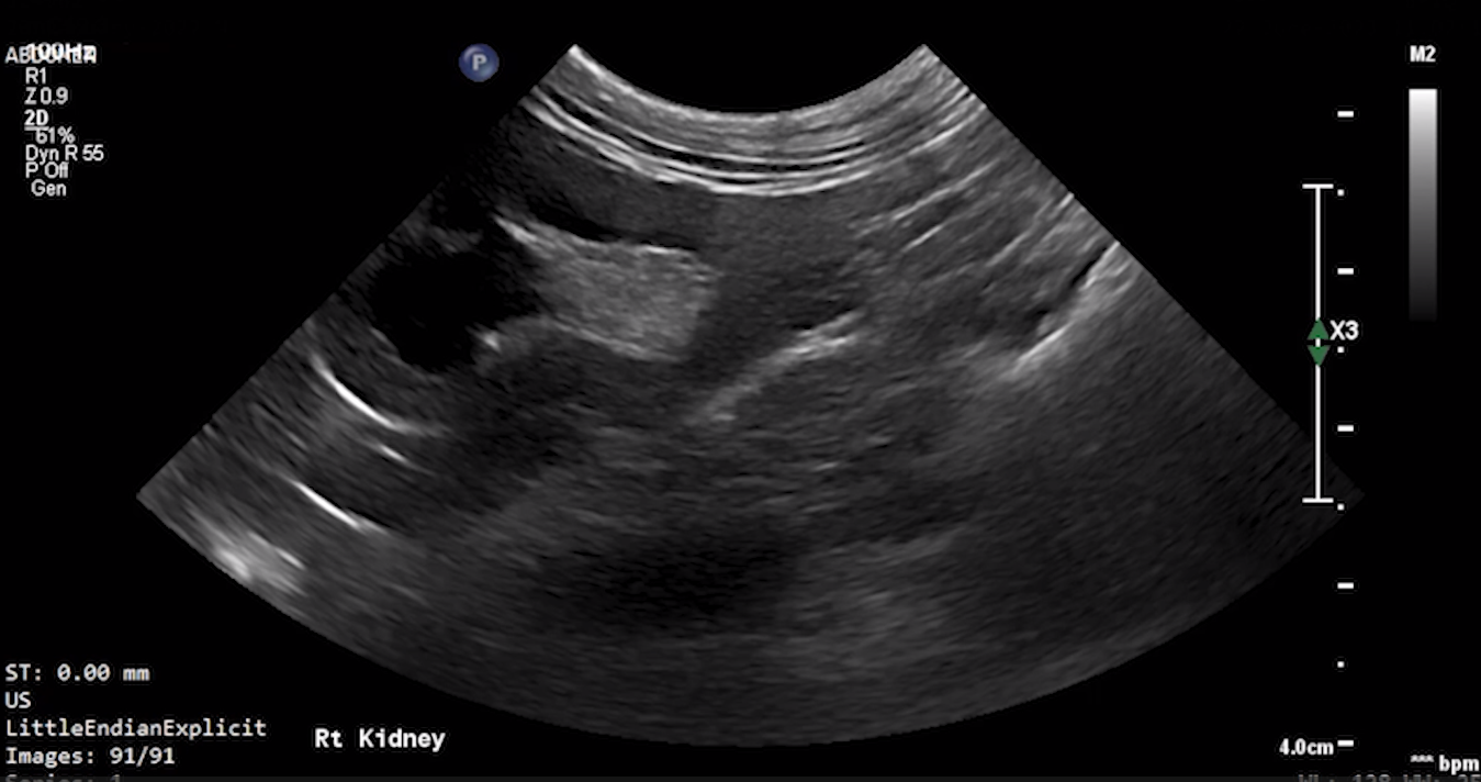 Feline Right Kidney (Longitudinal) 3 – NORMAL