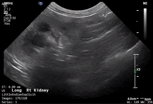 Feline Right Kidney (Longitudinal) 1 - NORMAL
