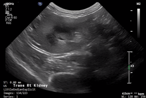 Feline Right Kidney (Transverse) - NORMAL