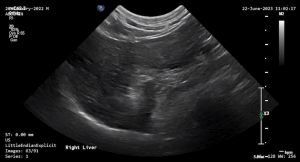 Feline Right Liver 2 - NORMAL