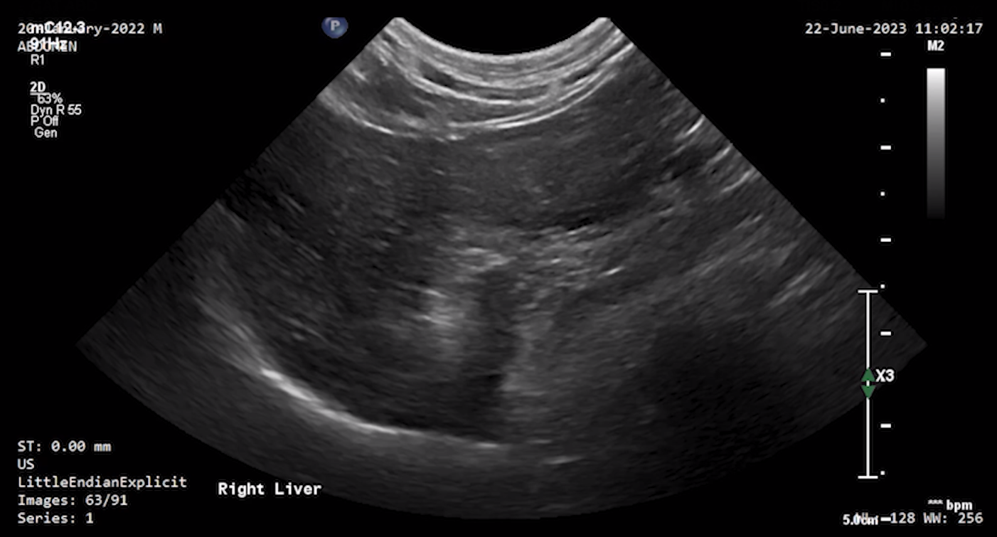 Feline Right Liver 2 – NORMAL