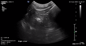 Feline Right Liver - NORMAL