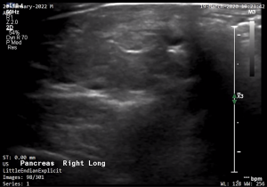 Feline Right Pancreas (Longitudinal) 1 - NORMAL