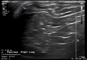 Feline Right Pancreas (Longitudinal) 2 - NORMAL