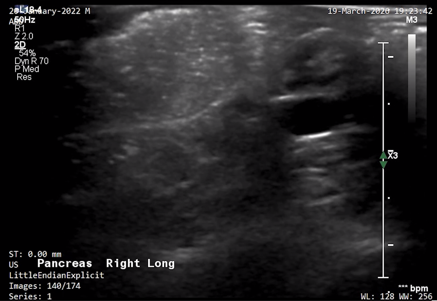 Feline Right Pancreas (Longitudinal) 3 – NORMAL