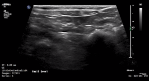 Feline Jejunum - NORMAL