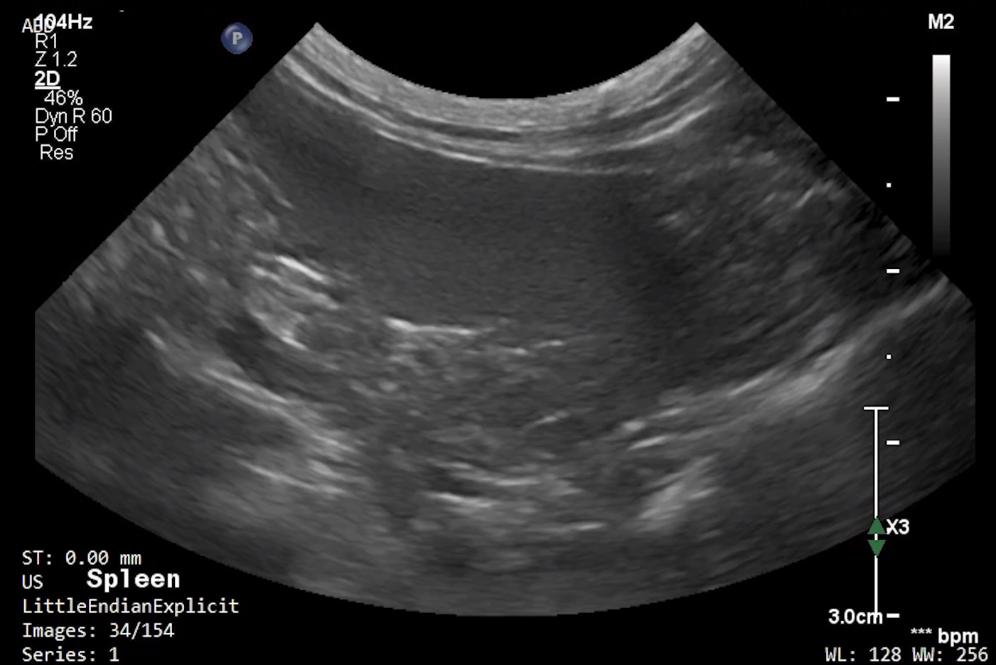 Feline Spleen 1 – NORMAL
