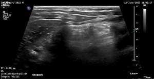 Feline Stomach 3 - NORMAL