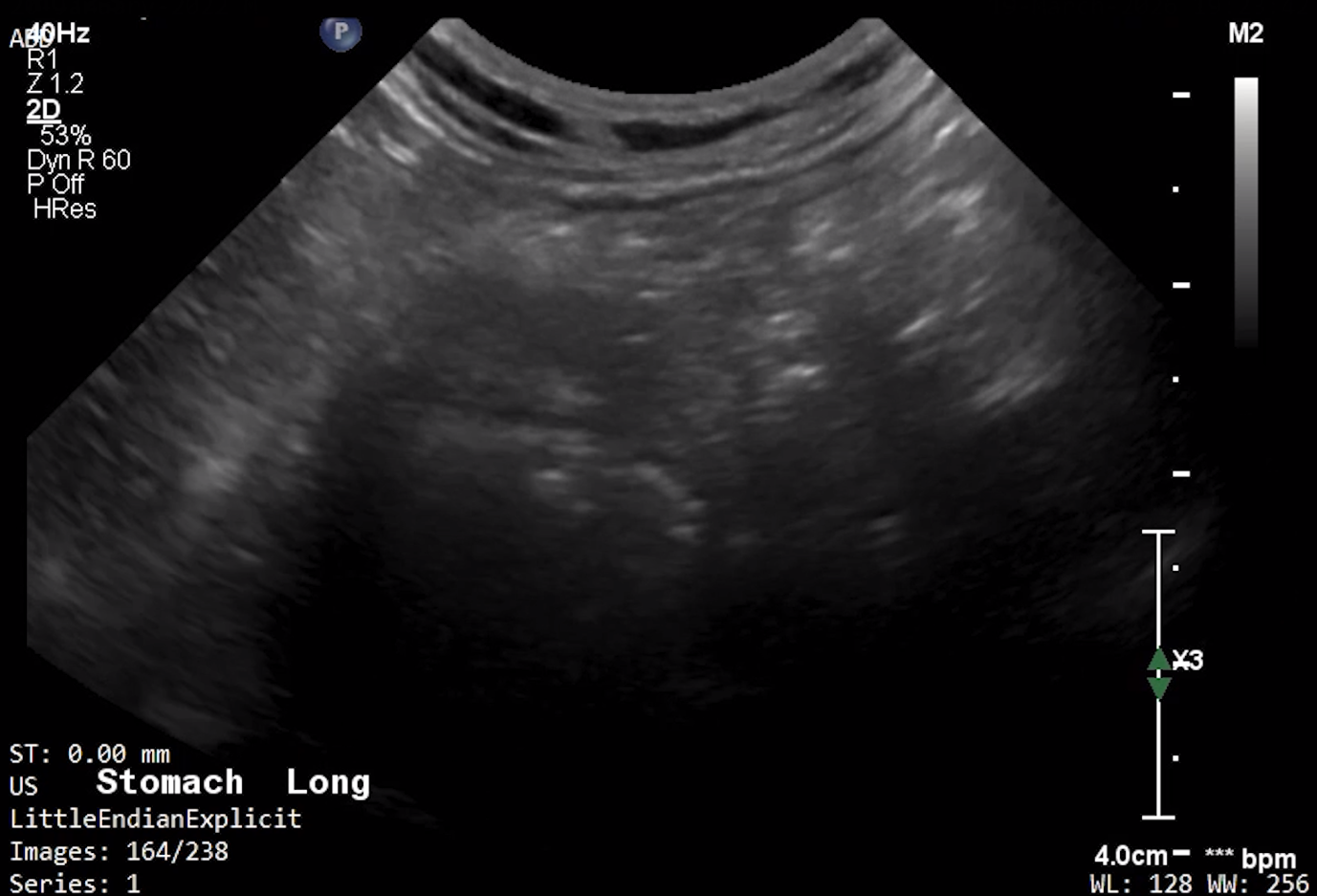 Feline Stomach (Longitudinal) – NORMAL