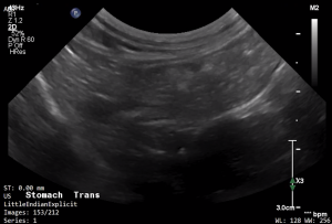 Feline Stomach (Transverse) - NORMAL